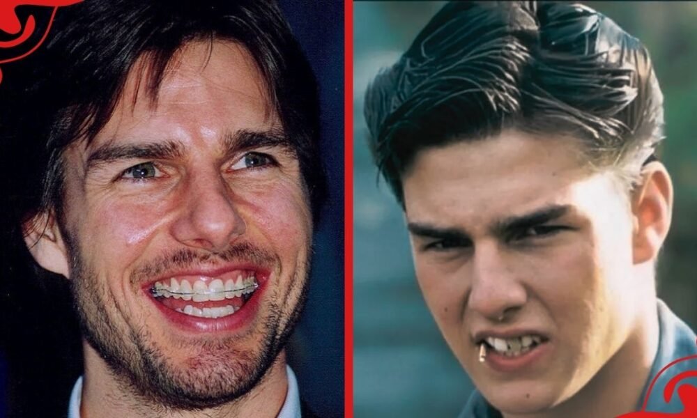 tom cruise teeth