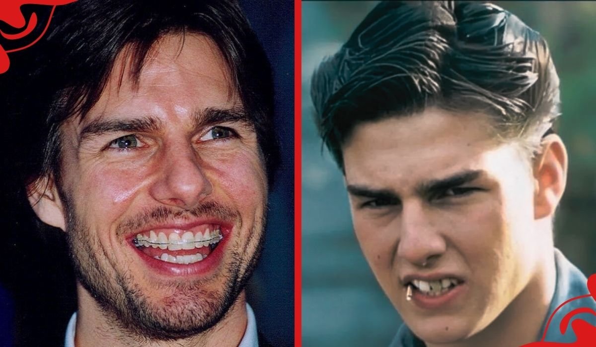 tom cruise teeth